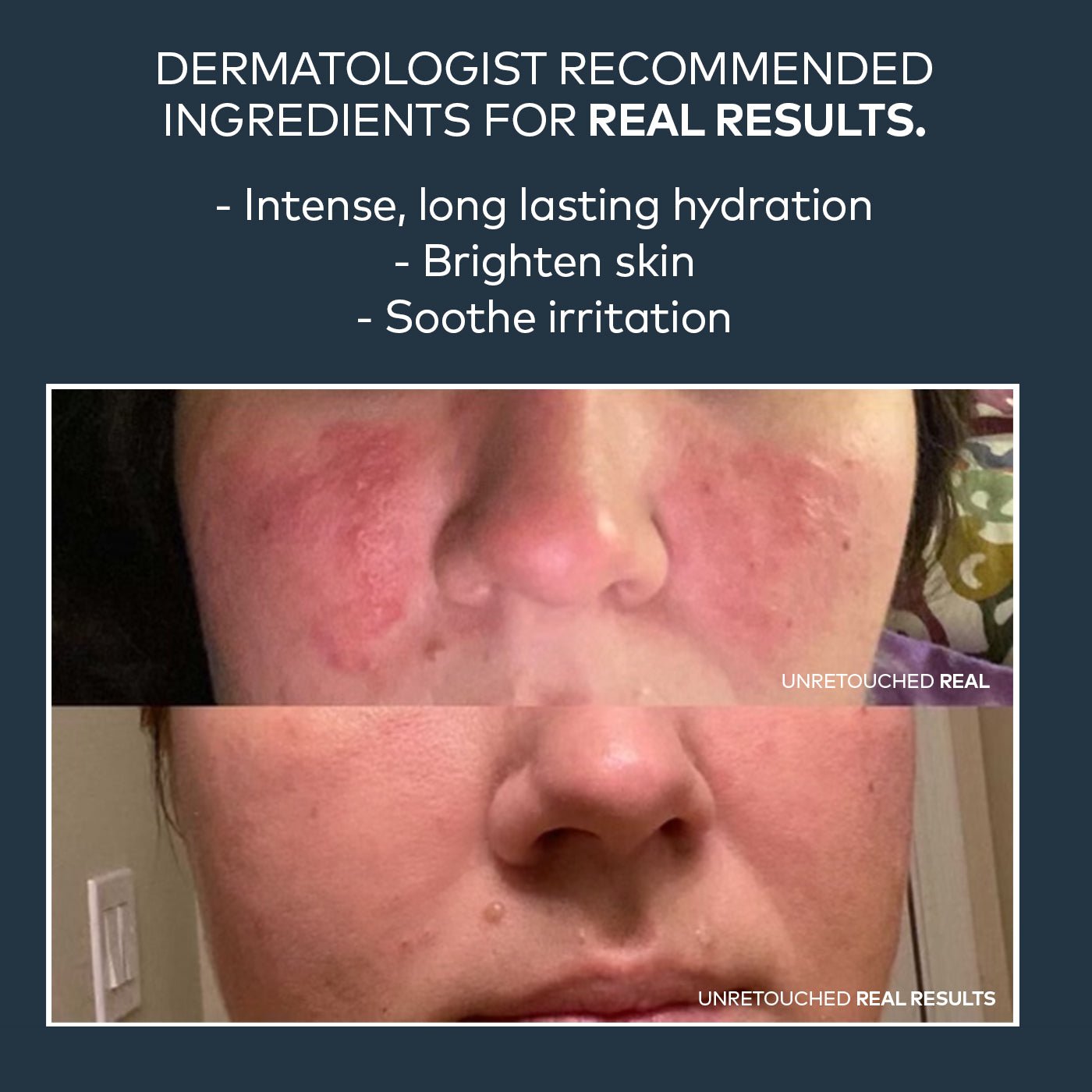 Dream Cream Nighttime Moisturizer - Onekind