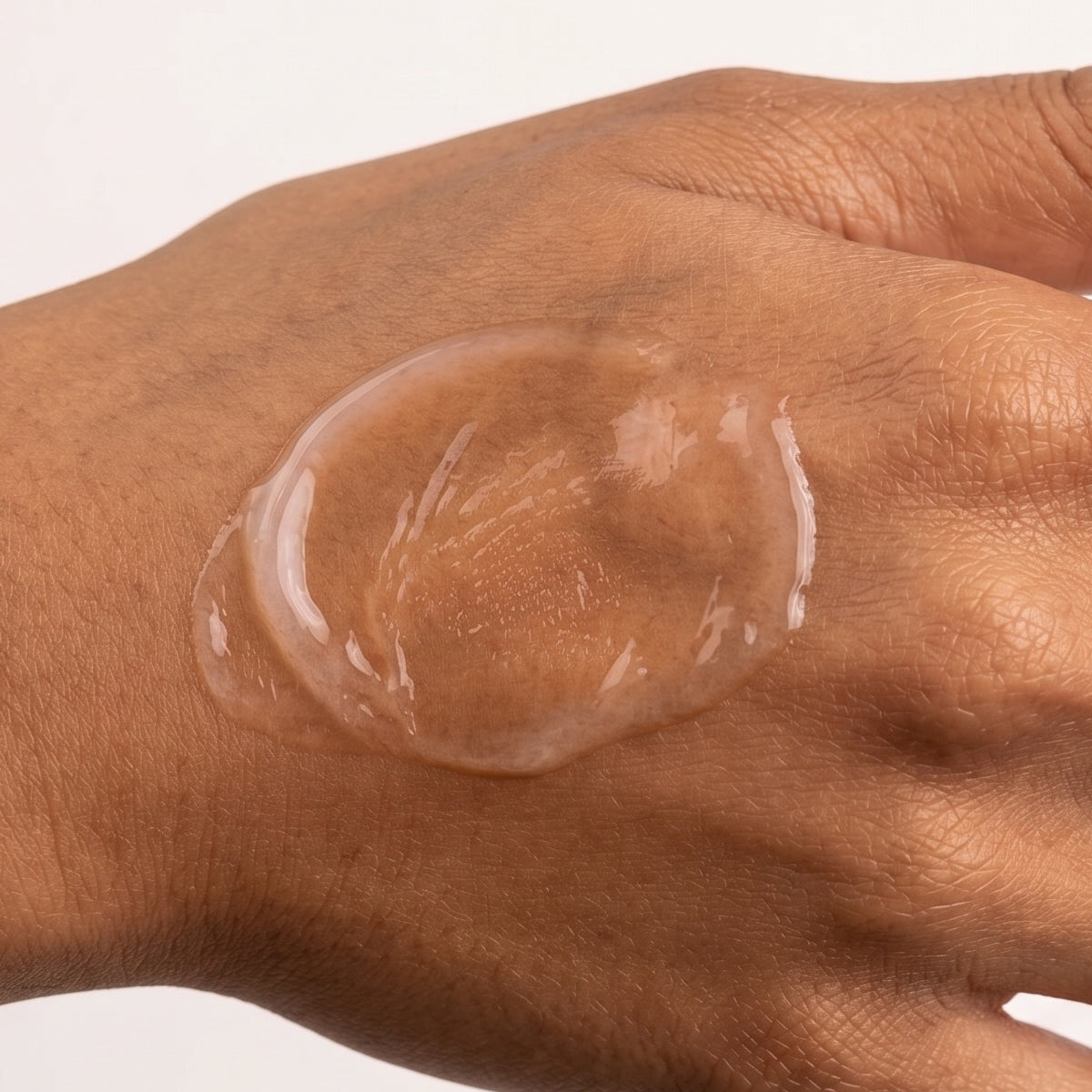 Can Oily, Blemish-Prone Skin Have a Damaged Moisture Barrier?