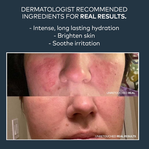 Dream Cream Nighttime Moisturizer - Onekind